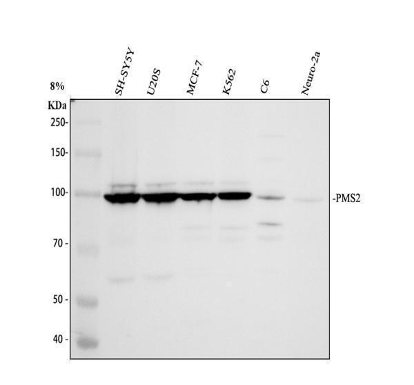 Western blot analysis of PMS2 using anti-PMS2 antibody (A01028)