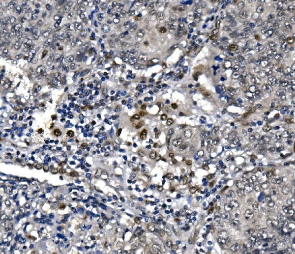 a01029 1 polr2a primary antibodies ihc testing 3