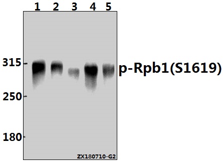 Western blot (WB) analysis of p-Rpb1 (S1619) pAb at 1:2000 dilution
Lane1:A549 whole cell lysate(40ug)
Lane2:Hela whole cell lysate(40ug)
Lane3:A2780 whole cell lysate(40ug)
Lane4:PC12 whole cell lysate(40ug)
Lane5:3T3-L1 whole cell lysate(40ug)