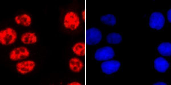 ICC staining Phospho-POLR2A (S2) in Hela cells (red)