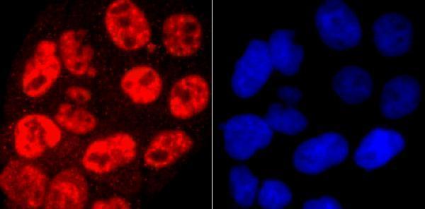 ICC staining Phospho-POLR2A (S5) in Hela cells (red)