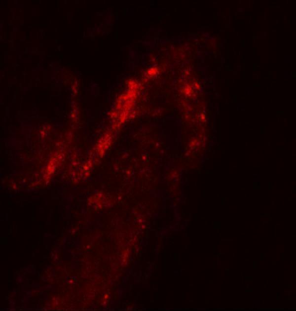 a01032 foxa2 primary antibodies if testing 2