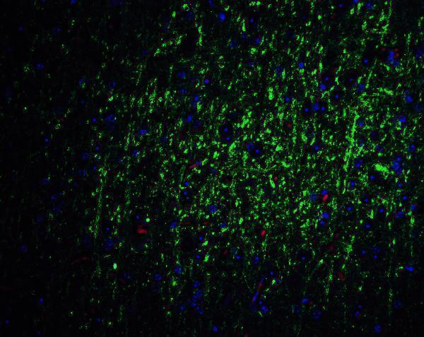 a01032 foxa2 primary antibodies if testing 4