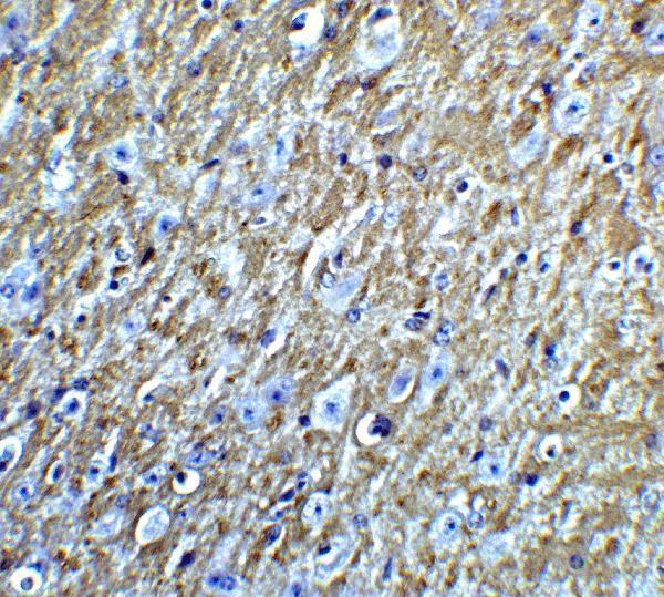 a01032 foxa2 primary antibodies ihc testing 3