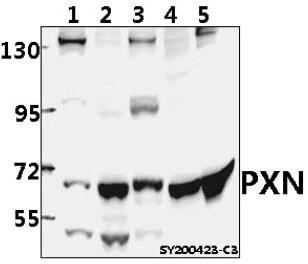 Western blot (WB) analysis of PXN polyclonal antibody at 1:1000 dilution
Lane1:MCF-7 whole cell lysate(40ug)
Lane2:Hela whole cell lysate(40ug)
Lane3:H460 whole cell lysate(40ug)
Lane4:PC12 whole cell lysate(40ug)
Lane5:CT-26 whole cell lysate(40ug)