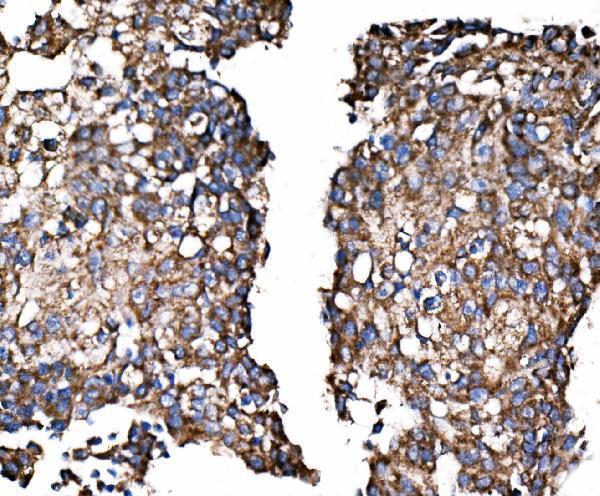  IHC analysis of Paxillin/PXN using anti-Paxillin/PXN antibody (A01033-2)