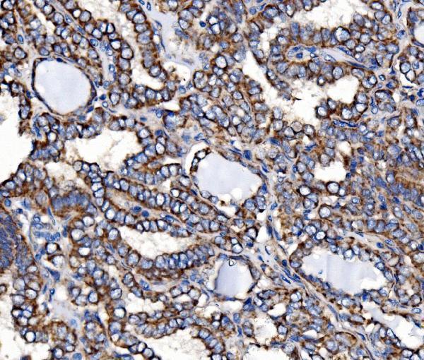  IHC analysis of Paxillin/PXN using anti-Paxillin/PXN antibody (A01033-2)