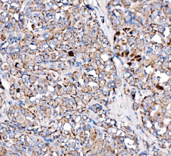 a01033 2 pxn primary antibodies ihc testing 4