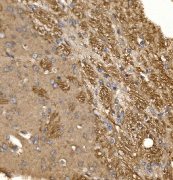 a01033 2 pxn primary antibodies ihc testing 5