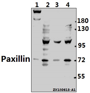 a01033 pxn primary antiboties wb testing 1