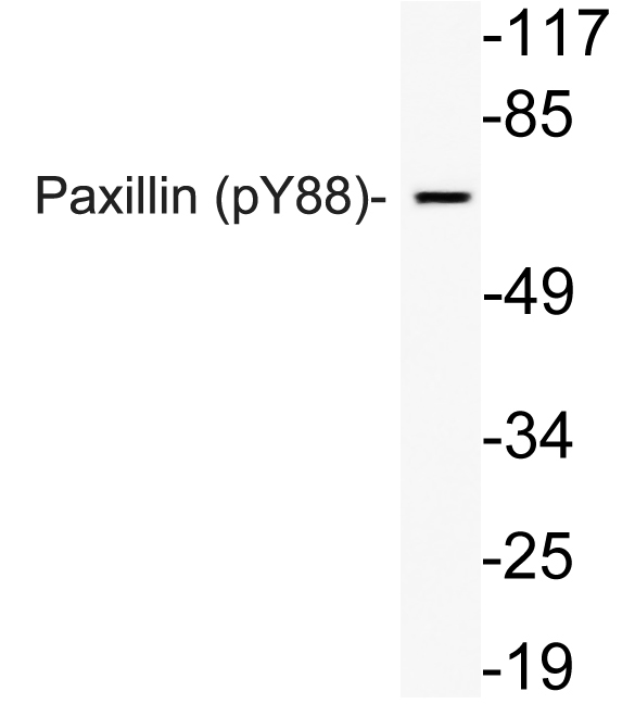 Western blot analysis of lysate from HeLa cells using phospho-Paxillin (Phospho-Tyr88) antibody