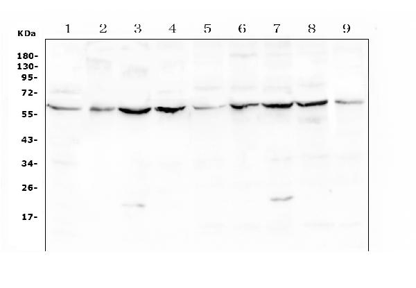 Western blot analysis of Lumican using anti-Lumican antibody (A01034-1). Electrophoresis was performed on a 5-20% SDS-PAGE gel at 70V (Stacking gel) / 90V (Resolving gel) for 2-3 hours. The sample well of each lane was loaded with 50ug of sample under reducing conditions. Lane 1: mouse liver tissue lysates, Lane 2: mouse ovary tissue lysates, Lane 3: mouse testis tissue lysates, Lane 4: mouse lung tissue lysates, Lane 5: rat liver tissue lysates, Lane 6: rat ovary tissue lysates, Lane 7: rat testis tissue lysates, Lane 8: rat lung tissue lysates, Lane 9: rat heart tissue lysates. After Electrophoresis, proteins were transferred to a Nitrocellulose membrane at 150mA for 50-90 minutes. Blocked the membrane with 5% Non-fat Milk/ TBS for 1.5 hour at RT. The membrane was incubated with rabbit anti-Lumican antigen affinity purified polyclonal antibody (Catalog # A01034-1) at 0.5 μg/mL overnight at 4°C, then washed with TBS-0.1%Tween 3 times with 5 minutes each and probed with a goat anti-rabbit IgG-HRP secondary antibody at a dilution of 1:10000 for 1.5 hour at RT. The signal is developed using an Enhanced Chemiluminescent detection (ECL) kit (Catalog # EK1002) with Tanon 5200 system. A specific band was detected for Lumican at approximately 58KD. The expected band size for Lumican is at 38KD.
