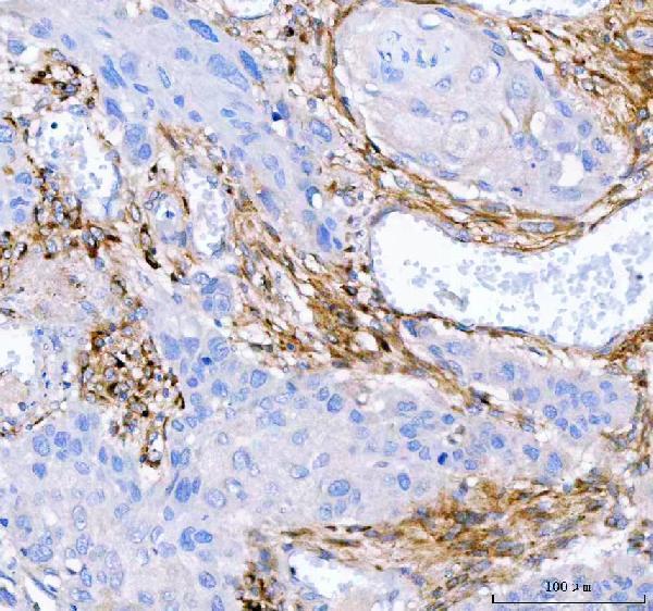  IHC analysis of Lumican/LUM using anti-Lumican/LUM antibody (A01034-2)