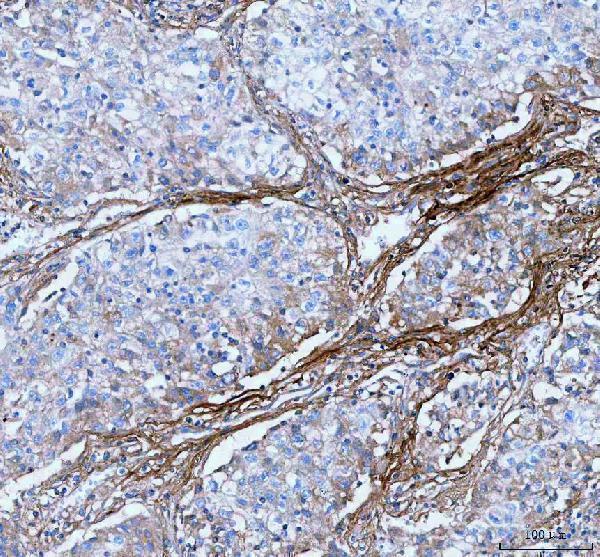  IHC analysis of Lumican/LUM using anti-Lumican/LUM antibody (A01034-2)