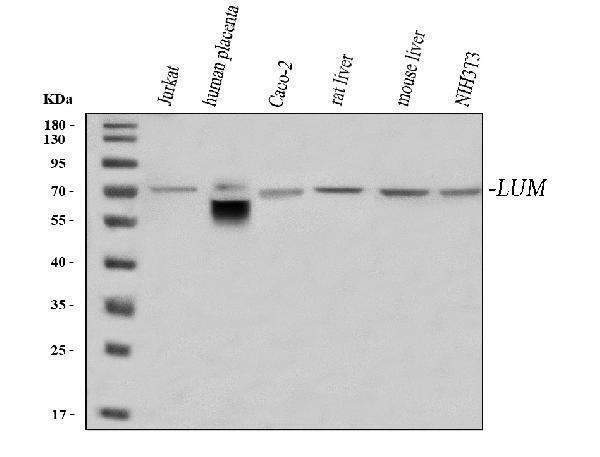  Western blot analysis of Lumican/LUM using anti-Lumican/LUM antibody (A01034-2)