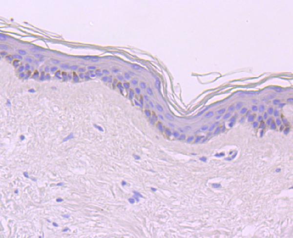 a01035 cdt1 primary antiboties ihc testing 2