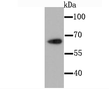 a01035 cdt1 primary antiboties wb testing 1