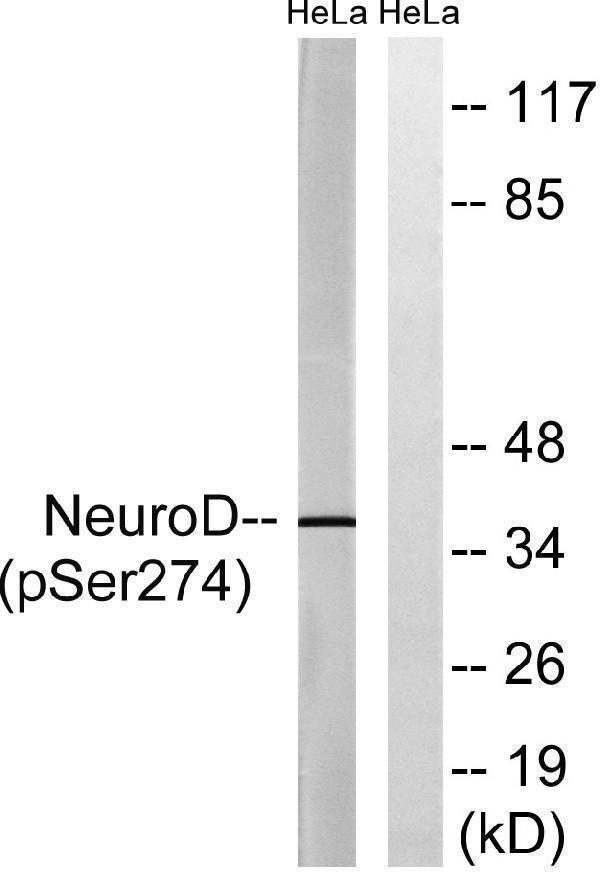 Western blot analysis of lysates from HeLa cells treated with UV 15', using Neuro D (Phospho-Ser274) Antibody