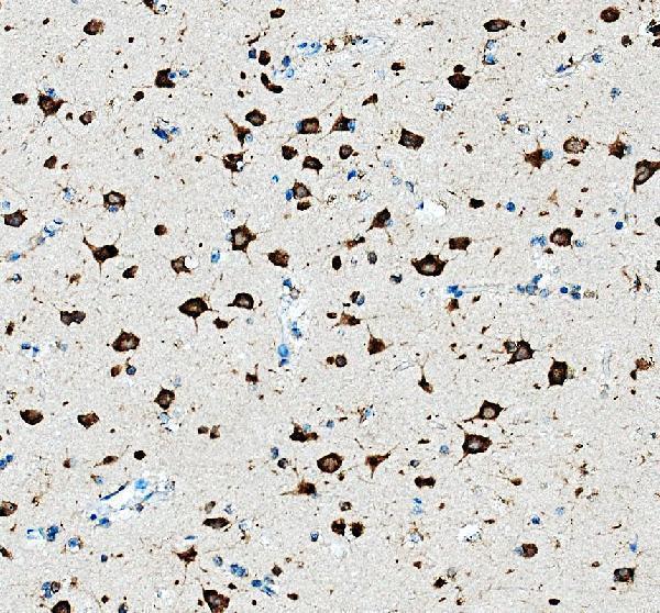 a01040 3 rps12 primary antibodies ihc testing 1