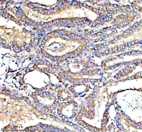 a01040 3 rps12 primary antibodies ihc testing 10