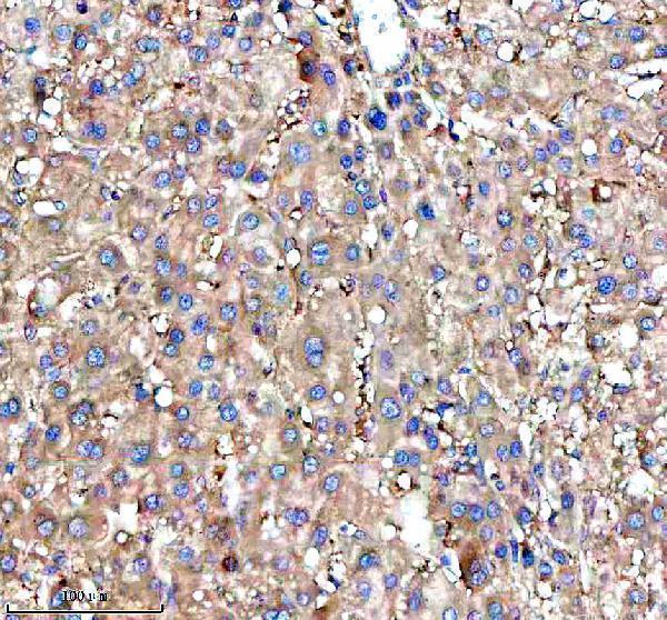 a01040 3 rps12 primary antibodies ihc testing 11