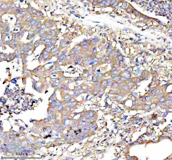 a01040 3 rps12 primary antibodies ihc testing 14