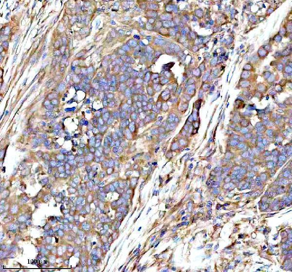 a01040 3 rps12 primary antibodies ihc testing 16