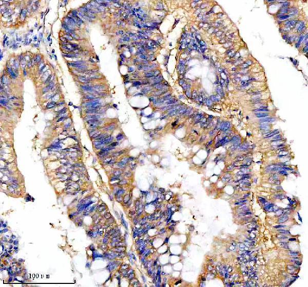 a01040 3 rps12 primary antibodies ihc testing 17