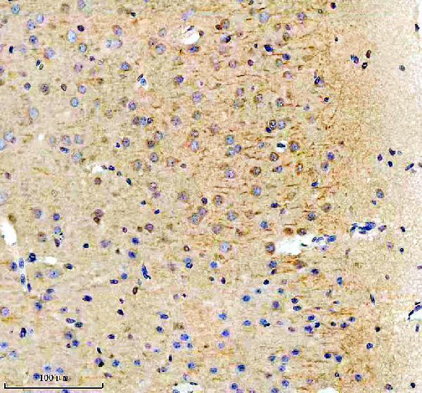 a01040 3 rps12 primary antibodies ihc testing 18