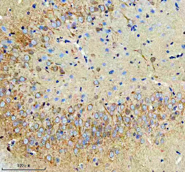 a01040 3 rps12 primary antibodies ihc testing 19