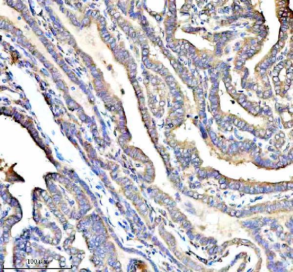  IHC analysis of RPS12 using anti-RPS12 antibody (A01040-3)