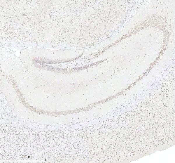 a01040 3 rps12 primary antibodies ihc testing 2_1