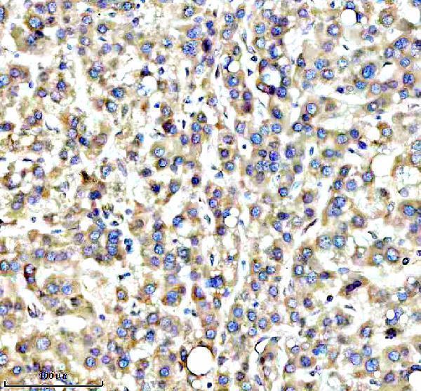  IHC analysis of RPS12 using anti-RPS12 antibody (A01040-3)