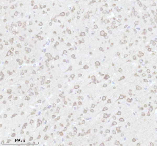 a01040 3 rps12 primary antibodies ihc testing 3_1
