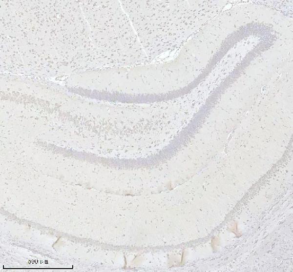 a01040 3 rps12 primary antibodies ihc testing 4_1