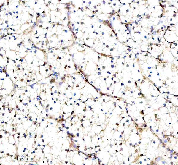a01040 3 rps12 primary antibodies ihc testing 5