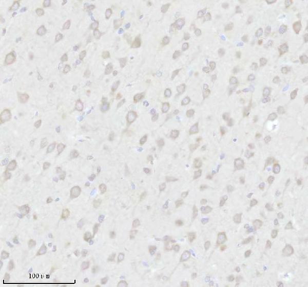 a01040 3 rps12 primary antibodies ihc testing 5_1