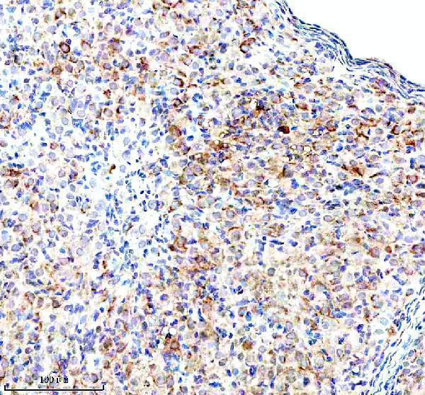 a01040 3 rps12 primary antibodies ihc testing 9