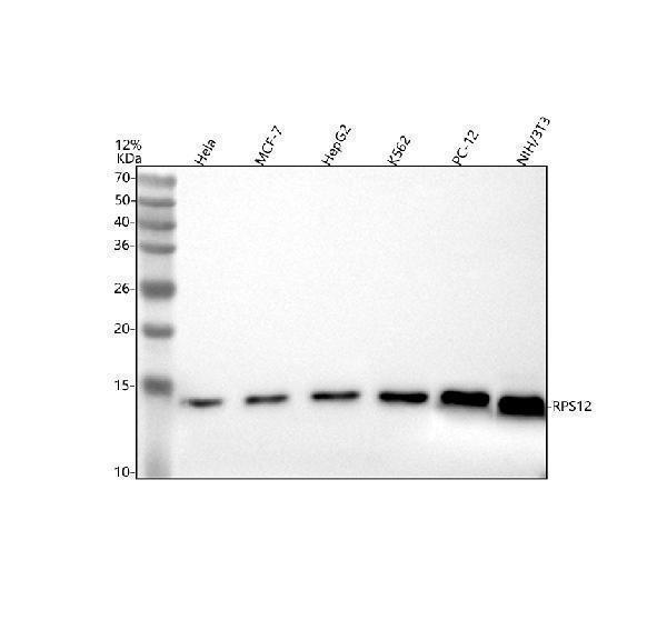  Western blot analysis of RPS12 using anti-RPS12 antibody (A01040-3)