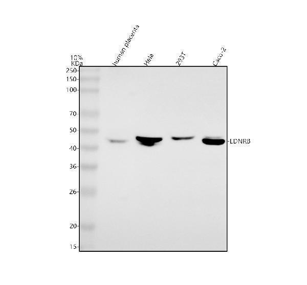  Western blot analysis of EDNRB using anti-EDNRB antibody (A01041)