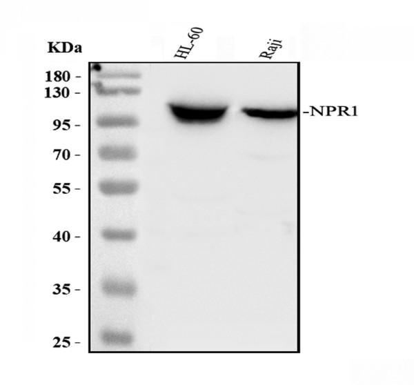 Western blot analysis of NPR1 using anti-NPR1 antibody (A01042)
