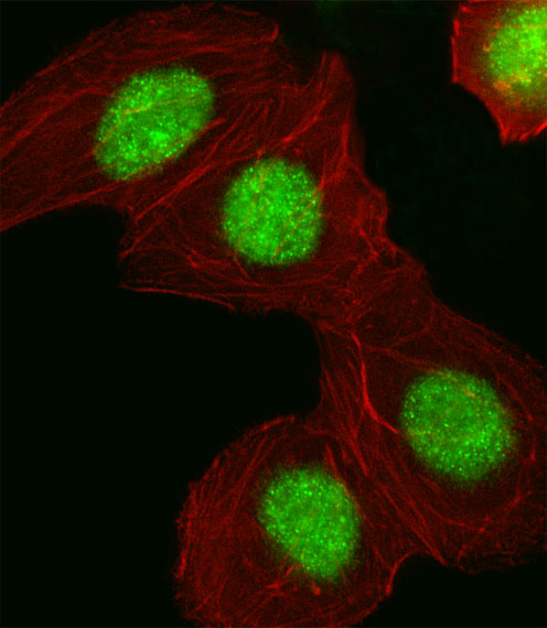 a01043 2 anti hmga1 antibody c term if testing 1
