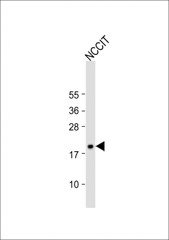 a01043 2 anti hmga1 antibody c term wb testing 2