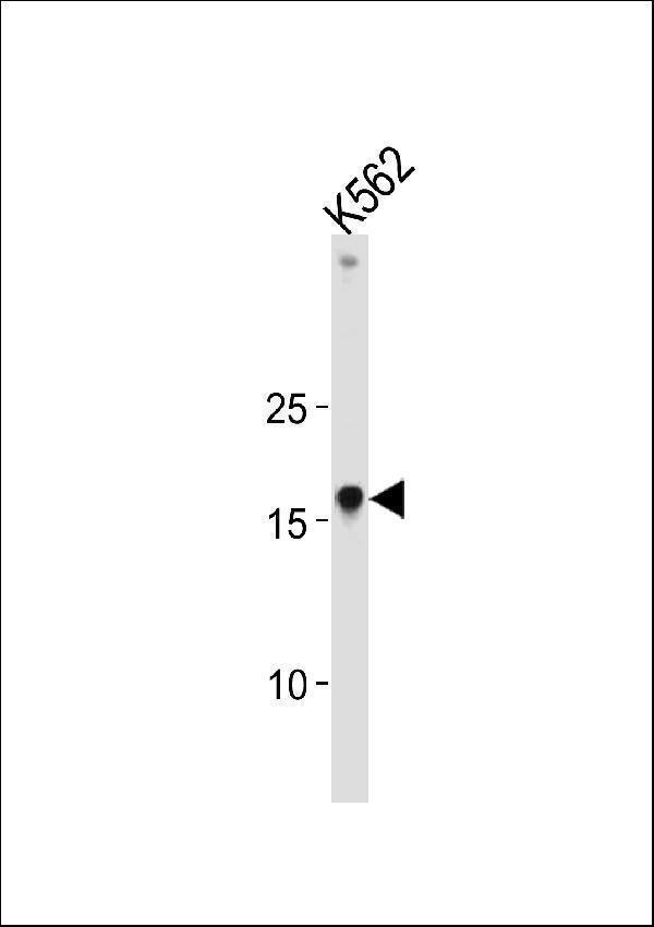 a01043 2 anti hmga1 antibody c term wb testing 3