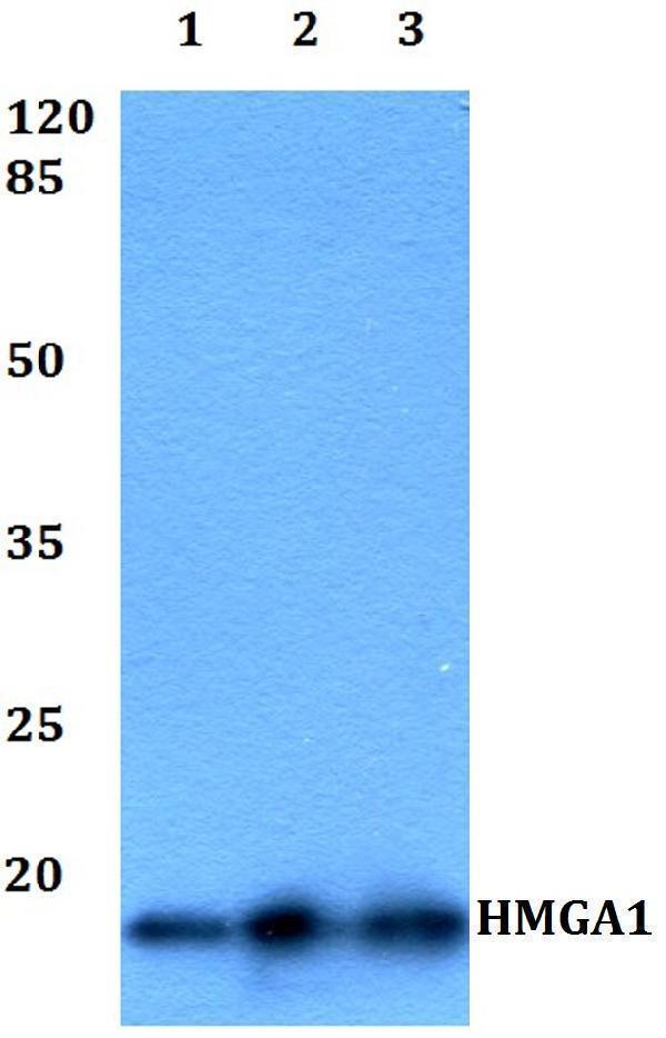 a01043 hmga1 primary antiboties wb testing 1