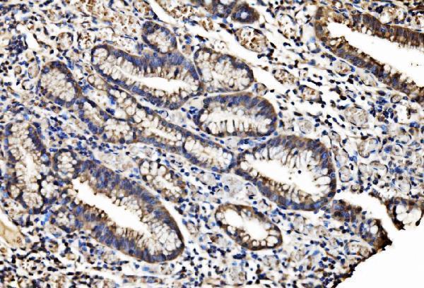 a01044 2 casp7 primary antibodies ihc testing 3