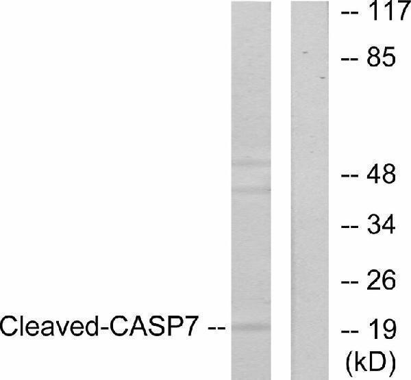 Western blot analysis of lysates from 293 cells, treated with Etoposide 25uM 60