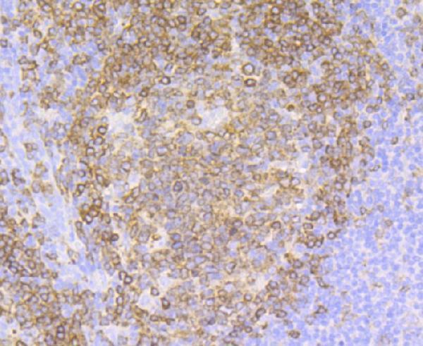 Immunohistochemical analysis of paraffin-embedded human tonsil tissue using anti-CD79a antibody