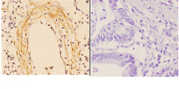 a01048 1 abca4 primary antiboties ihc testing 2
