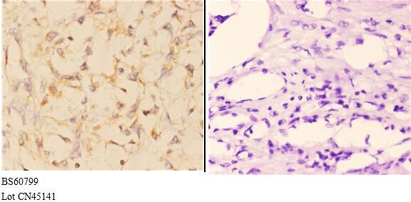 a01048 1 abca4 primary antiboties ihc testing 3